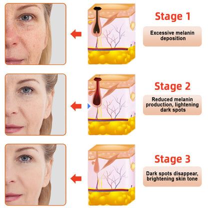 ODEIUN™ Purifying Exfoliating Gel for Acanthosis Nigricans, Exfoliation, Dark Spots, Skin Tags, and Eczema