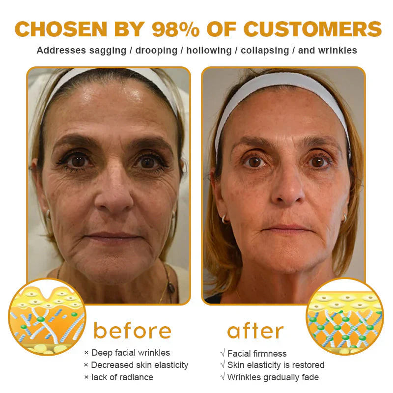 【Official Shop】 AllyBee® Skin Treatment Cream Anti-aging, Hydrating, Skin Repair, Even Tone, Acne and Dark Spot Treatment, Wart and Mole Removal, Psoriasis Relief