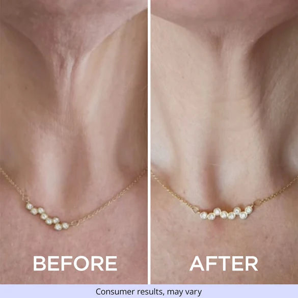 🔥Last Day 70% OFF🔥-ODEIUN™ Tighten & Lift Neck Cream